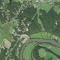 68-year-old woman has allergic reaction with breathing trouble