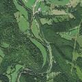 Woman with chest pain and vomiting near Appalachian Hwy