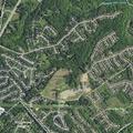 Possible broken bone after fall near Southwind Place