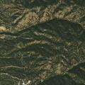62-year-old woman having difficulty breathing at camp