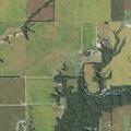 79-year-old male fallen with broken ribs and breathing trouble