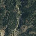 21-year-old woman with heart problems at campground
