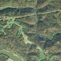 65-year-old man with left arm pain at State Route 60