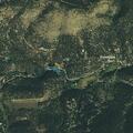 Woman treated for severe nosebleed in Evergreen