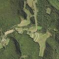 60-year-old woman with breathing difficulties in Fort Hill