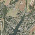 70-year-old woman with chest pain and tingling in Gettysburg