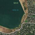 65-year-old woman with abdominal pain in Arvada