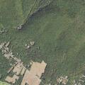 89-year-old man has multiple seizures at home