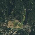 59-year-old woman with severe breathing trouble in Meadow Valley