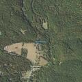 Person experiencing heart problems in Metal Township