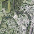 9-year-old girl having dizzy spells in Connellsville