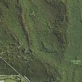 Person with abdominal pain near Pheasant Run Lane in Champion
