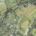 80-year-old woman with breathing issues after fall