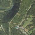 Woman with rectal bleeding in Saxton area