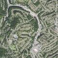 Female with infected amputated toe near Brentwood