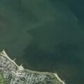 67-year-old woman with breathing difficulty and swollen legs