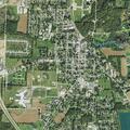 78-year-old woman with abdominal pain in Fredericktown