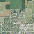 67-year-old man bleeding after brain surgery in Celina
