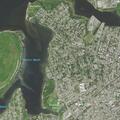 Person with abdominal pain at Cozy Acres in Queens