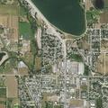 92-year-old man with diarrhea and dark stool at trailer park