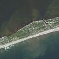 28-year-old man with dislocated joint on beach