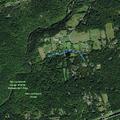 66-year-old man with chest pains in Califon