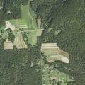 80-year-old female with upper rib pain in Winfield Township