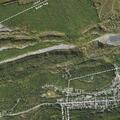 Medical assist for lifting near Girardville