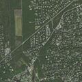 25-year-old woman with dislocated shoulder at East End Ave