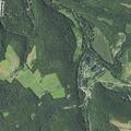 72-year-old man unresponsive with possible seizure at campground