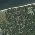 71-year-old male with abdominal pain in Wading River