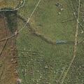 Person with abnormal lab results near Homer Way in Emporium Township