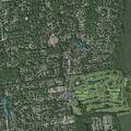Woman with shingles pain near James Lane