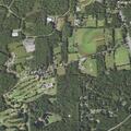 Female patient with rectal bleeding in Butler Township