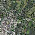 20-year-old female with chest pain at North Washington St