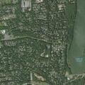 50-year-old woman has abdominal pain in West Nyack