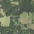 65-year-old woman with multiple TIAs at Greenville Pike