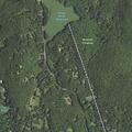 73-year-old male with arm discomfort in Pound Ridge