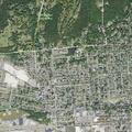 Severe breathing difficulty in 65-year-old woman