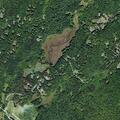 22-year-old female with heart palpitations at Fox Hollow Rd