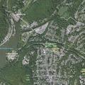 60-year-old male bleeding from dialysis shunt in Peekskill