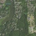Person with fever after surgery near Mohegan Lake