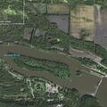 Man fainted at Starved Rock Lodge after bypass surgery
