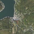 7-year-old male retaining fluid at Harvey's Lake Shores