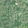 72-year-old man having a seizure at home