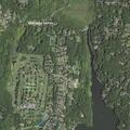 56-year-old woman with right-side numbness in Mahopac