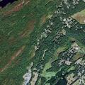 78-year-old man with breathing difficulty in Port Jervis