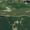 12-year-old with severe sunburn and breathing emergency at Camp Cedars