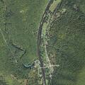 Person with chest and abdominal pain at Cedar Run