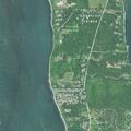 101-year-old woman with rectal bleeding at Bayberry Road